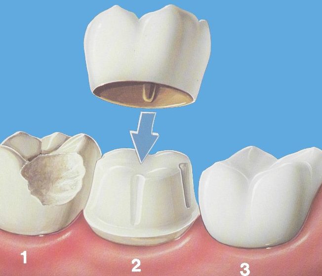 درمانهای دندانپزشکی زیبایی